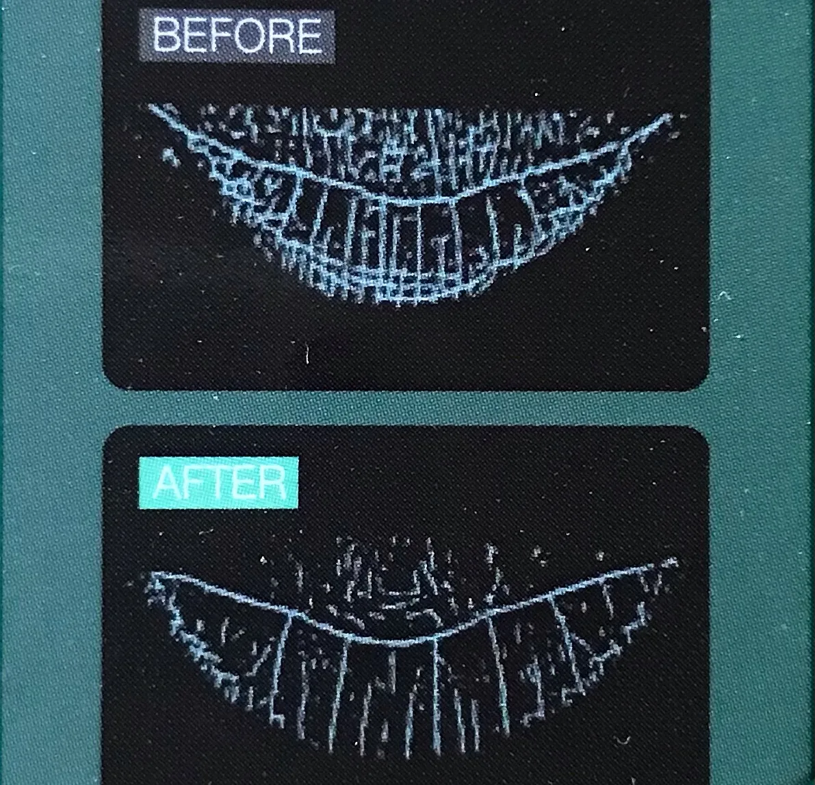 本日は、以前にも投稿したビューティーワールドジャパンという、...
