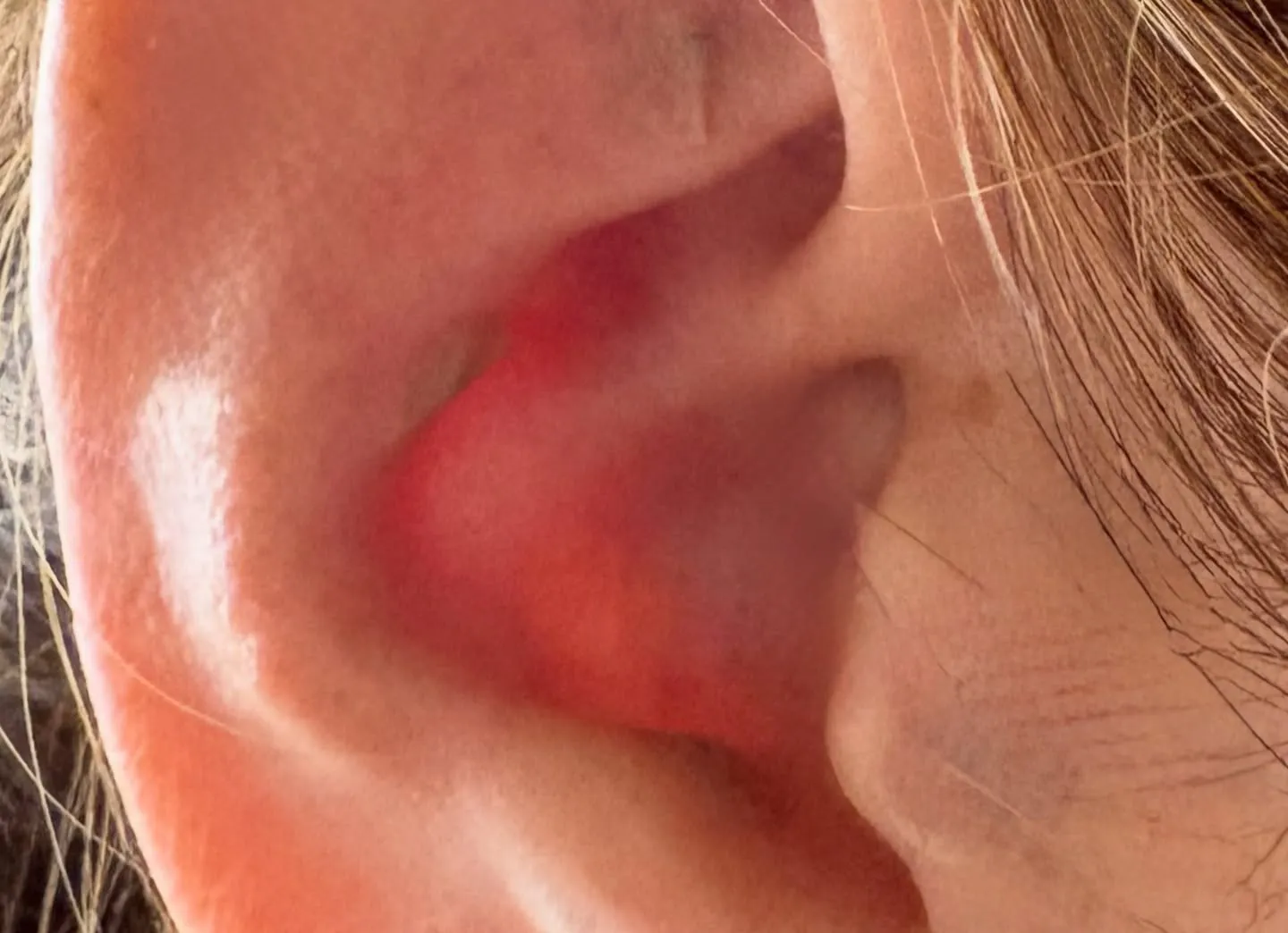 本日は、耳つぼジュエリーのジュエリー無しの肌色シールと透明の...