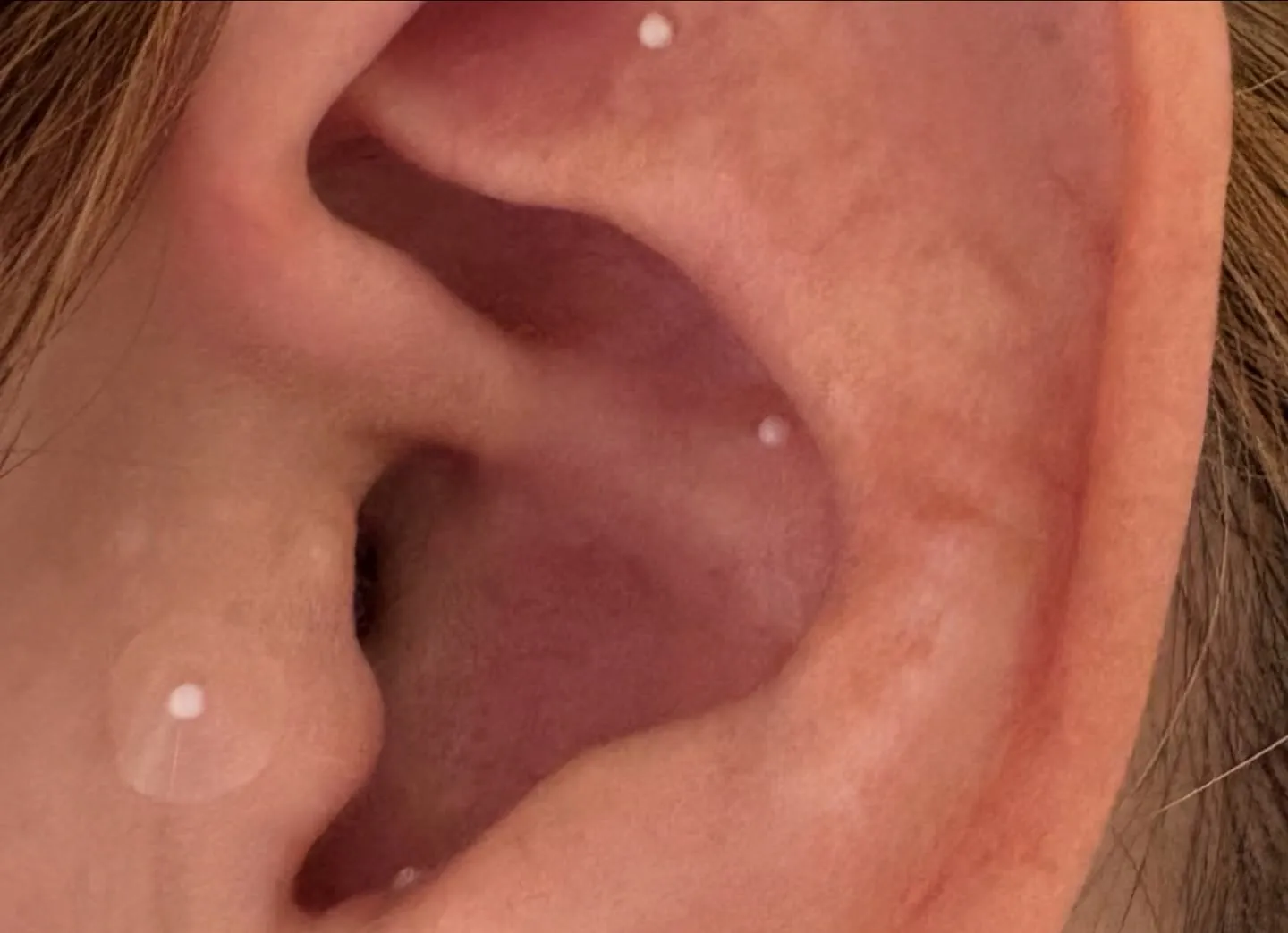 本日は、耳つぼジュエリーのジュエリー無しの肌色シールと透明の...