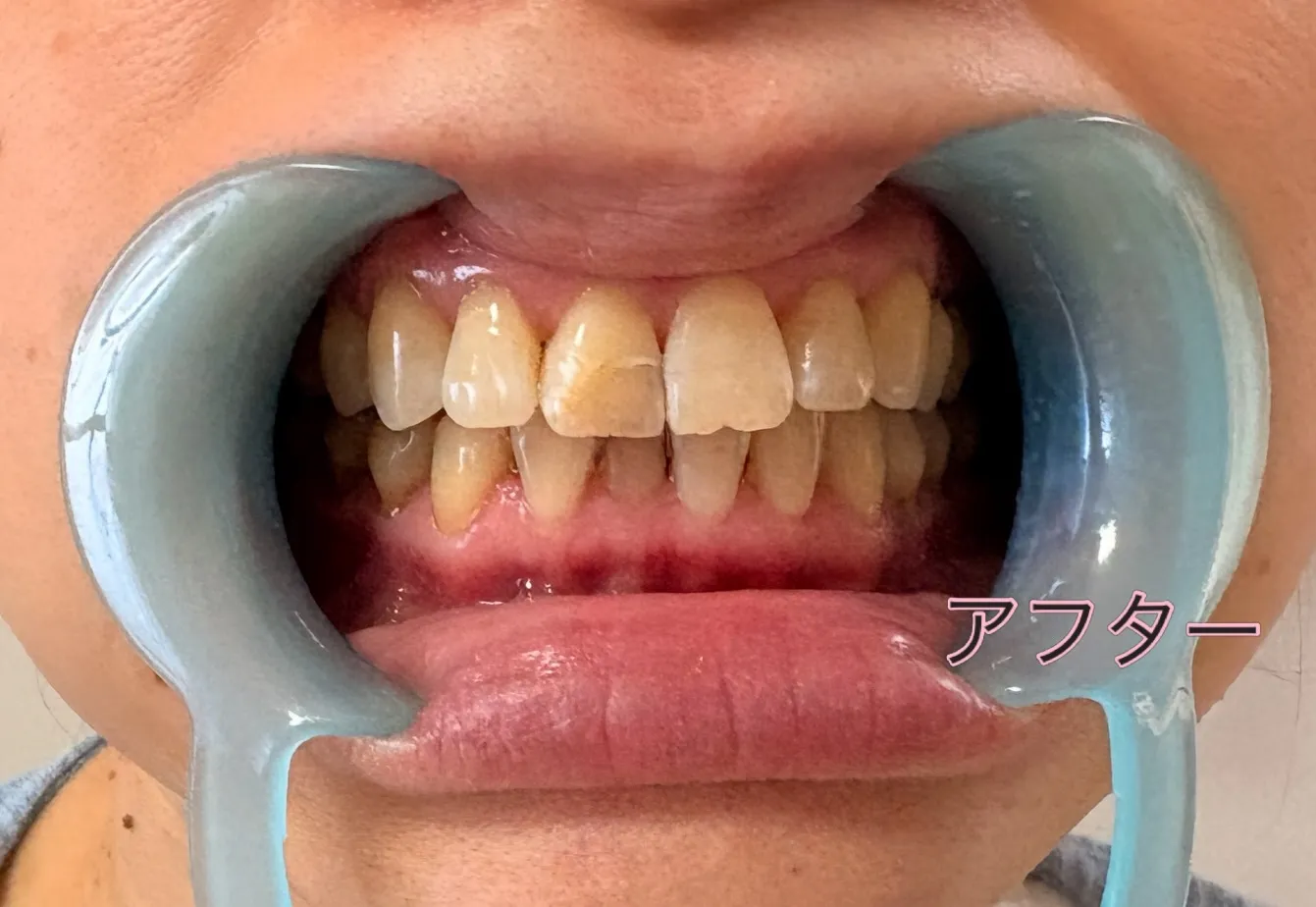 本日は、ちょっと意外なお話です🦷